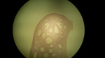 MISSING THUMBNAIL